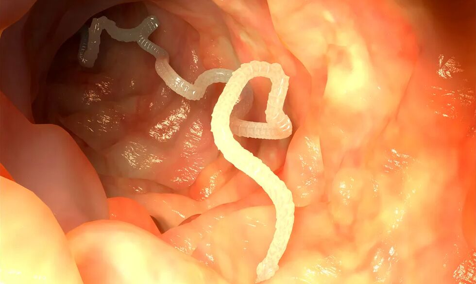 Luminalwürmer infizieren den Darm