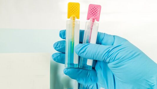 Parasit Diagnostics -Methoden