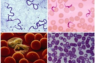 Welche Parasiten können im menschlichen Blut sein