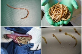Welche Parasiten können im menschlichen Darm leben 